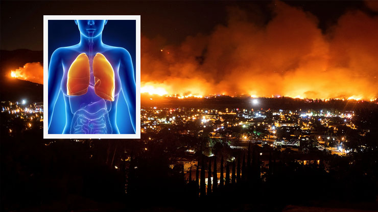 How to Protect Your Lung Health During Wildfire Season