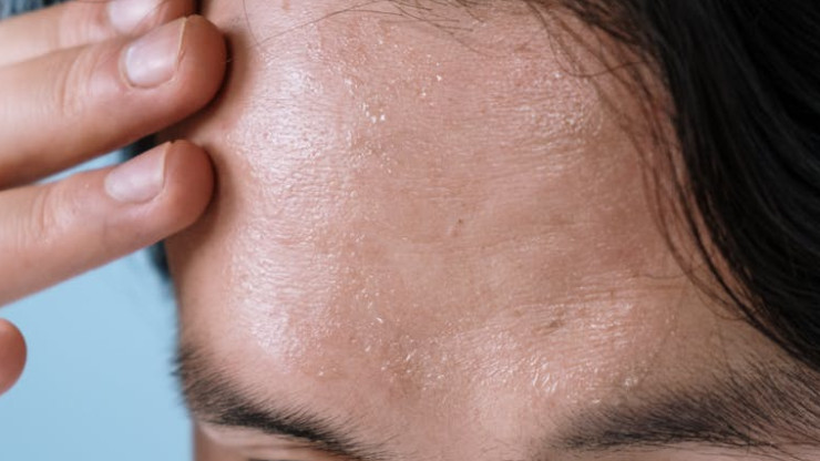 Why Does My Sweat Smell Like Vinegar?