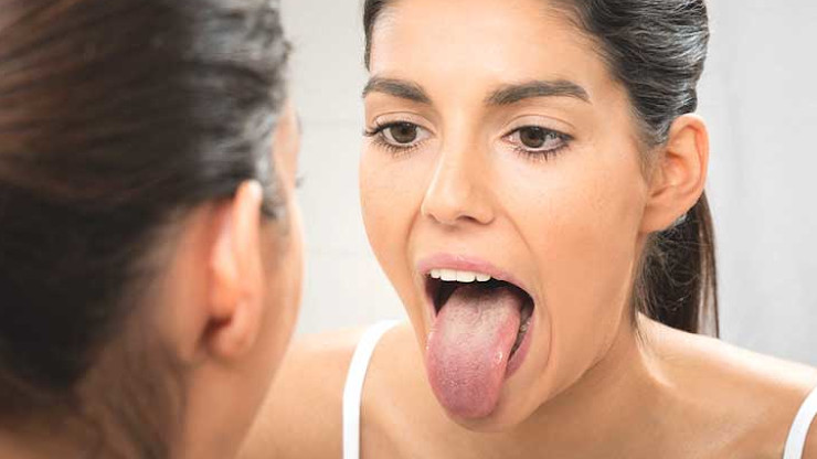 Why Is My Tongue Green?