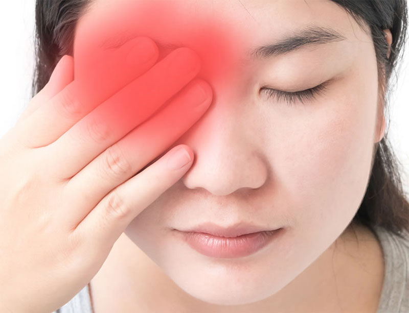 Cancel Cluster Headaches
