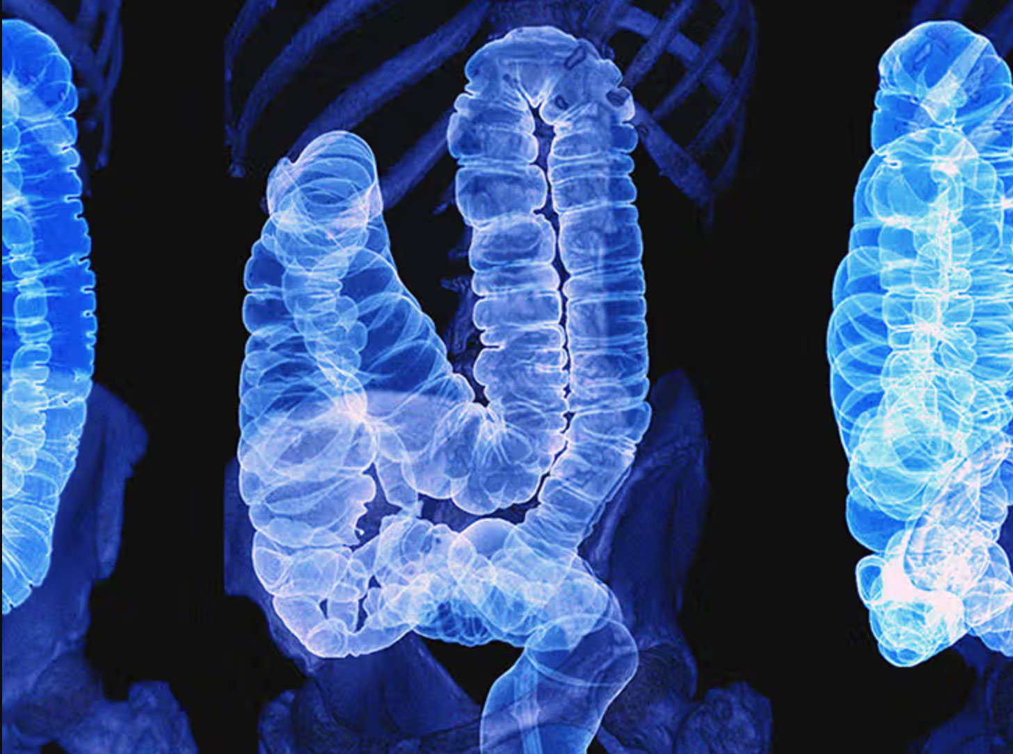 can constipation cause back pain _466701ef 8064 4ae7 8aeb 7241617c46e0