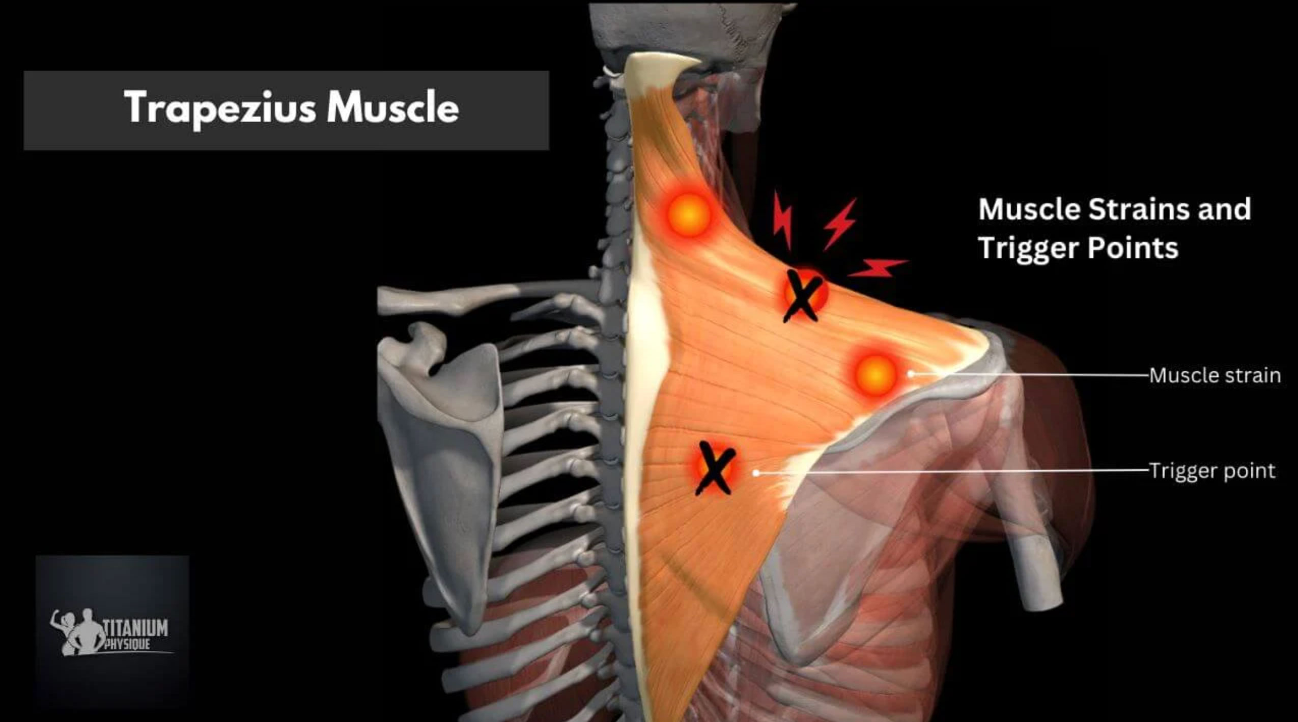 relieve trapezius muscle pain_075eacc2 4da1 4137 9142 65d99fc9a040