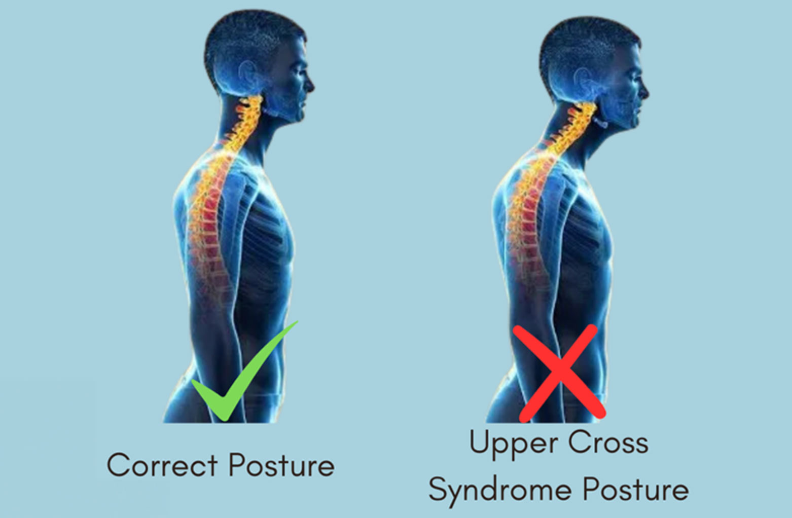 relieve trapezius muscle pain_0ab48213 0d01 49d4 9ff8 30d5e146ddc6
