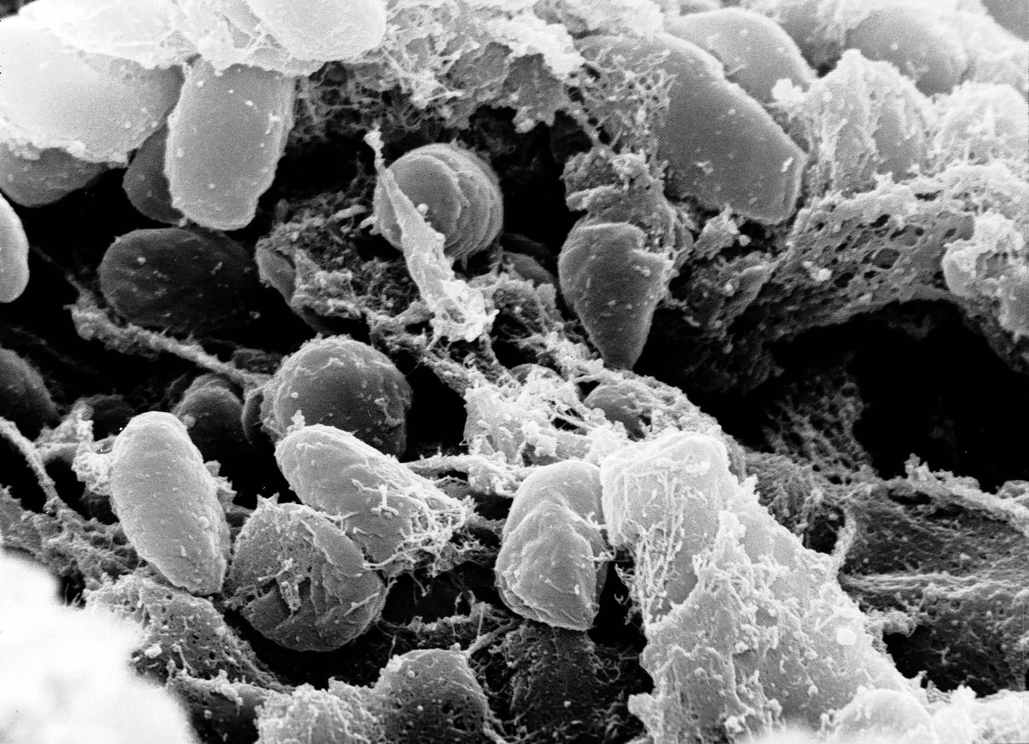 1791296107460_Yersinia_pestis